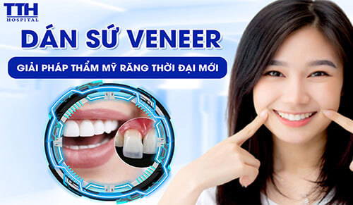 DÁN SỨ VENEER - GIẢI PHÁP THẨM MỸ RĂNG THỜI ĐẠI MỚI