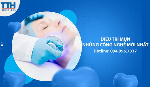 Điều trị mụn - Những công nghệ mới nhất