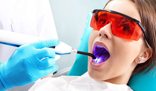 Điều Trị Tủy Bằng Laser là gì?