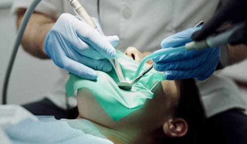 Điều trị tủy răng sống: Quy trình và lợi ích