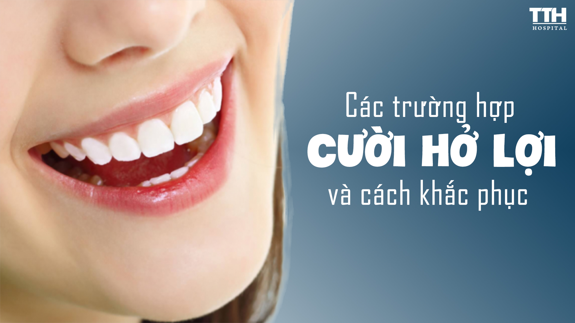 CÁC TRƯỜNG HỢP CƯỜI HỞ LỢI VÀ BIỆN PHÁP KHẮC PHỤC