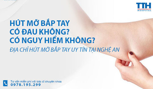 Hút mỡ bắp tay có đau không? Hút mỡ bắp tay ở đâu uy tín tại Nghệ An?