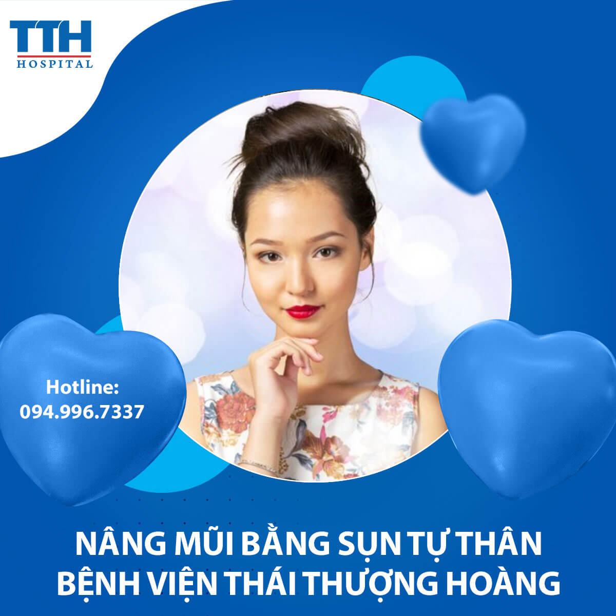 Nâng Mũi Bằng Sụn Tự Thân: Lựa Chọn An Toàn và Tự Nhiên