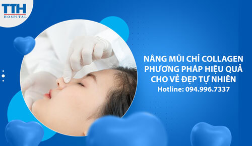 Nâng Mũi Chỉ Collagen - Phương Pháp Hiệu Quả Cho Vẻ Đẹp Tự Nhiên