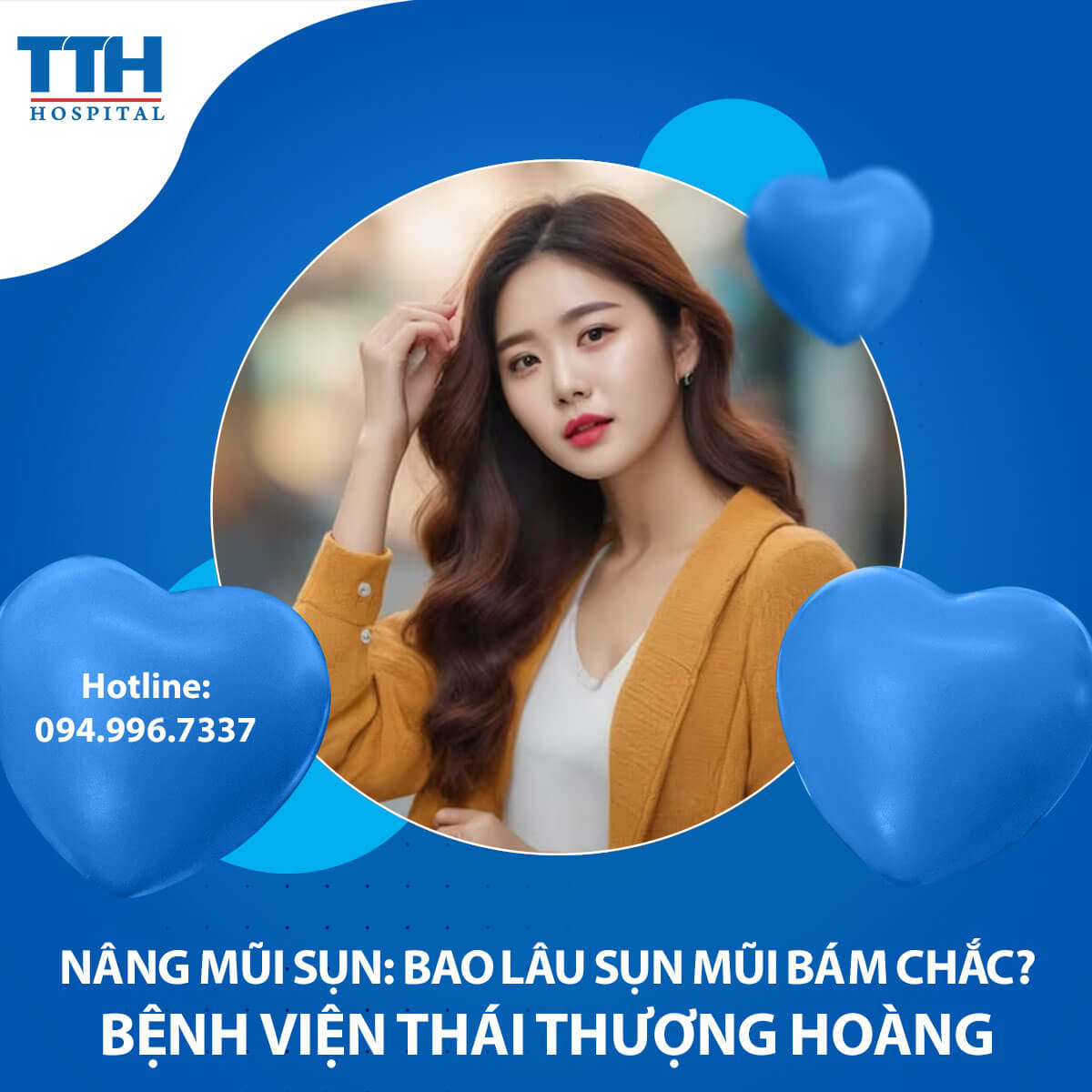 Nâng Mũi Sụn: Bao Lâu Sụn Mũi Bám Chắc?