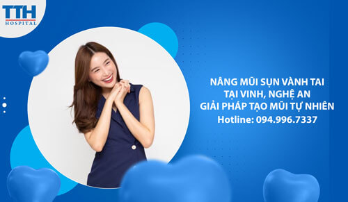 Nâng Mũi Sụn Vành Tai tại Vinh, Nghệ An - Giải Pháp Tạo Dáng Mũi Tự Nhiên