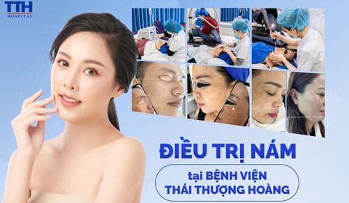 Nguyên Nhân Gây Nám Da Và Cách Phòng Tránh Hiệu Quả