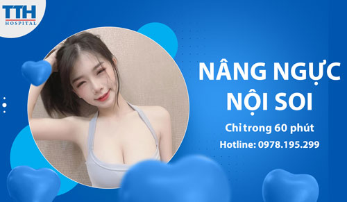 Nâng ngực nội soi chỉ trong 60 phút