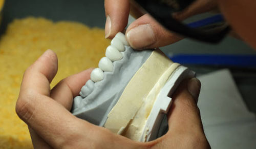 Răng Sứ Zirconia: Tính Năng Chịu Lực và Độ Bền Vượt Trội