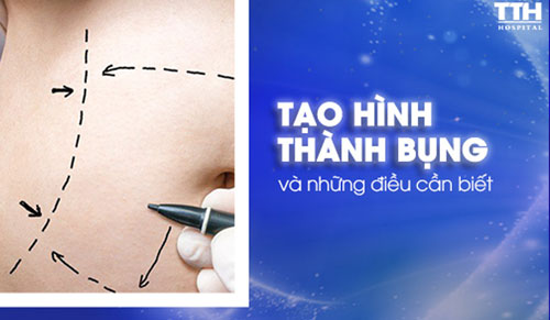Tạo hình thành bụng tại Nghệ An và những điều cần biết