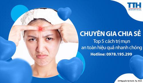 Top 5 cách trị mụn an toàn hiệu quả nhanh chóng