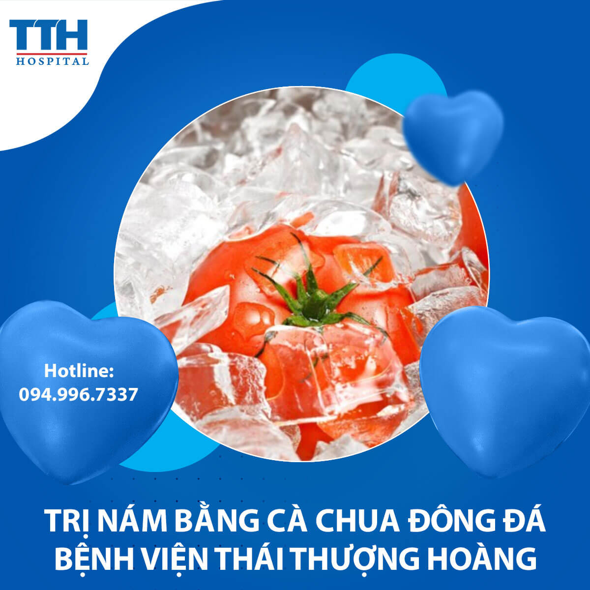 Trị Nám Bằng Cà Chua Đông Đá: Bí Quyết Sáng Da Tự Nhiên