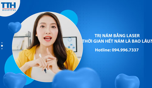 Trị Nám Bằng Laser: Thời Gian Hết Nám Là Bao Lâu?