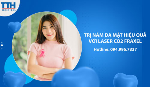 Trị Nám Da Mặt Hiệu Quả Với Công Nghệ Laser CO2 Fraxel