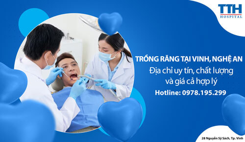 Trồng răng tại Vinh, Nghệ An: Địa chỉ uy tín, chất lượng và giá cả hợp lý