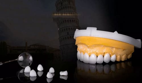 Ưu điểm của Răng sứ Orodent: Đột phá trong thẩm mỹ và chất lượng nha khoa